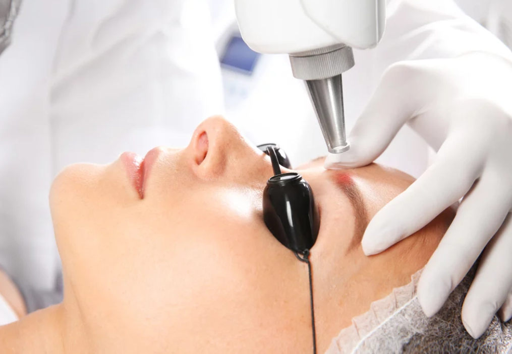 borrado-micropigmentación-microblading-despigmentación