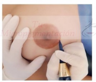 micropigmentación-areolas-mamarias-pigmentos-paramédica-oncológica
