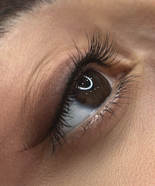 migracion-pigmento-ojos-micropigmentacion