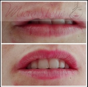 micropigmentación-labios-precio-que-es